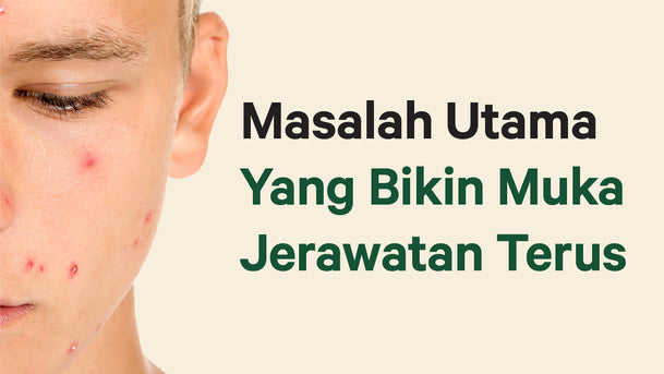 Masalah Utama Yang Bikin Muka Jerawatan Terus