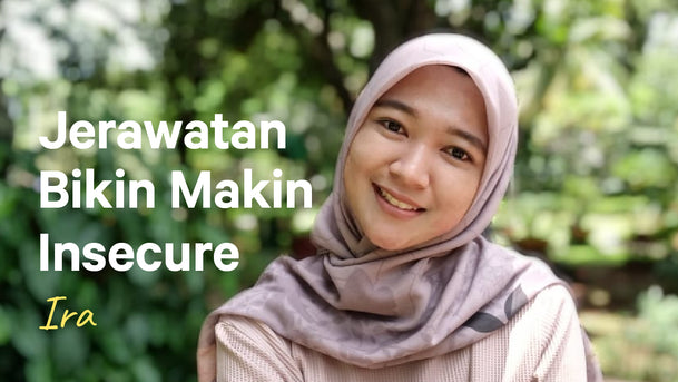 Ira, Jerawatan Bikin Makin Insecure